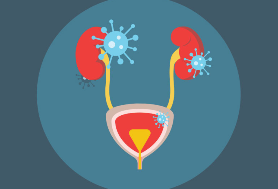 gejala infeksi saluran kemih