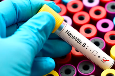 gejala hepatitis b