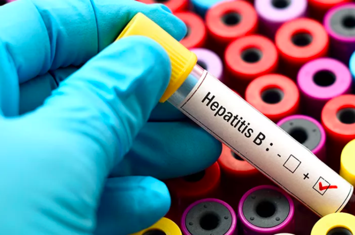 gejala hepatitis b