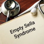 penyakit empty sella syndrome