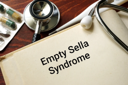 penyakit empty sella syndrome